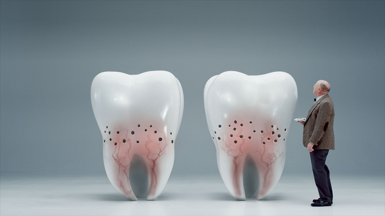 MACRO TEXTURING & DENTAL VEINS